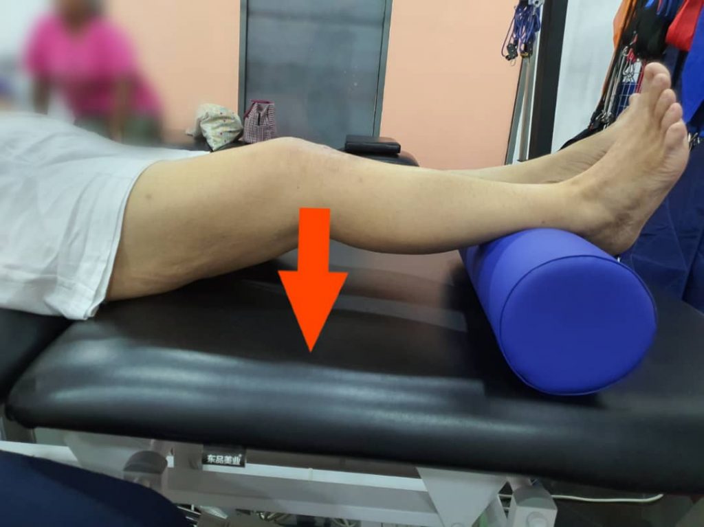 Total Knee Replacement Surgery cyriaxphysio